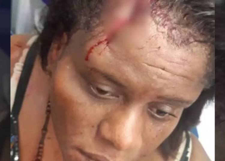 Recibe atenciones medicas mujer que resulto herida en estacion del Metro al caerle panel de luz