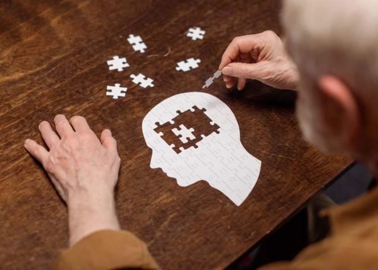 Alzheimer scaled 1