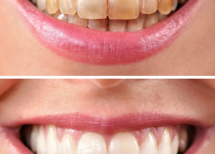 AdobeStock 48829269 1500x1000.jpeg