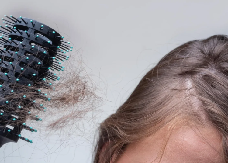 Tratamientos naturales para combatir la caída del cabello