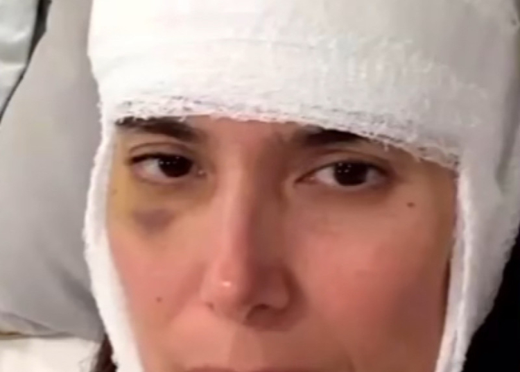 Actriz roselyn sánchez sufre aparatosa caída al intentar detener a su perro; resulta con brazo roto y golpes