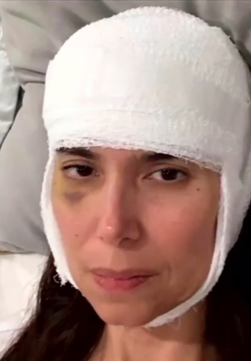 Actriz roselyn sánchez sufre aparatosa caída al intentar detener a su perro; resulta con brazo roto y golpes