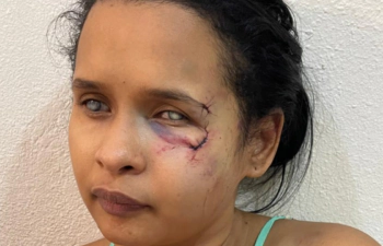 Mujer no vidente denuncia agresión por su pareja en monseñor nouel