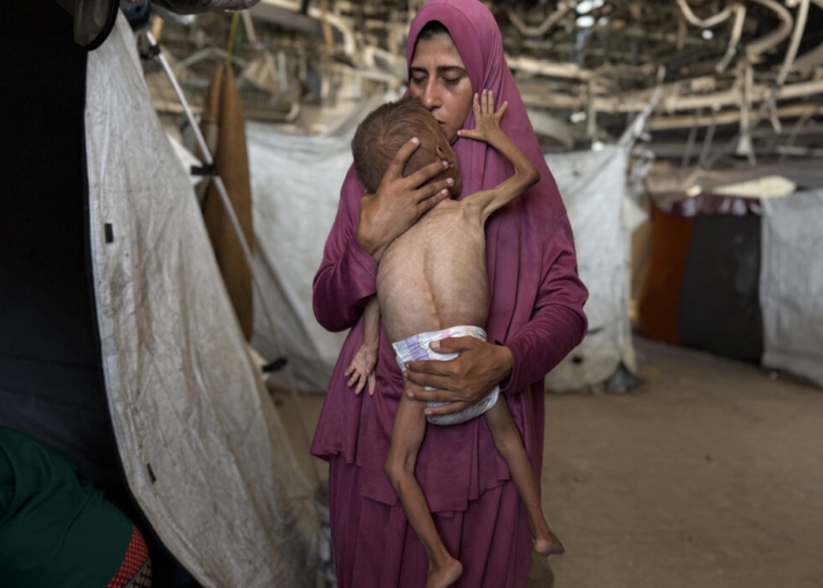 Un niño gazatí de 18 meses, de cuerpo esquelético, en brazos de su madre en una imagen del 26 de julio de 2025. Efe/ahmad awad