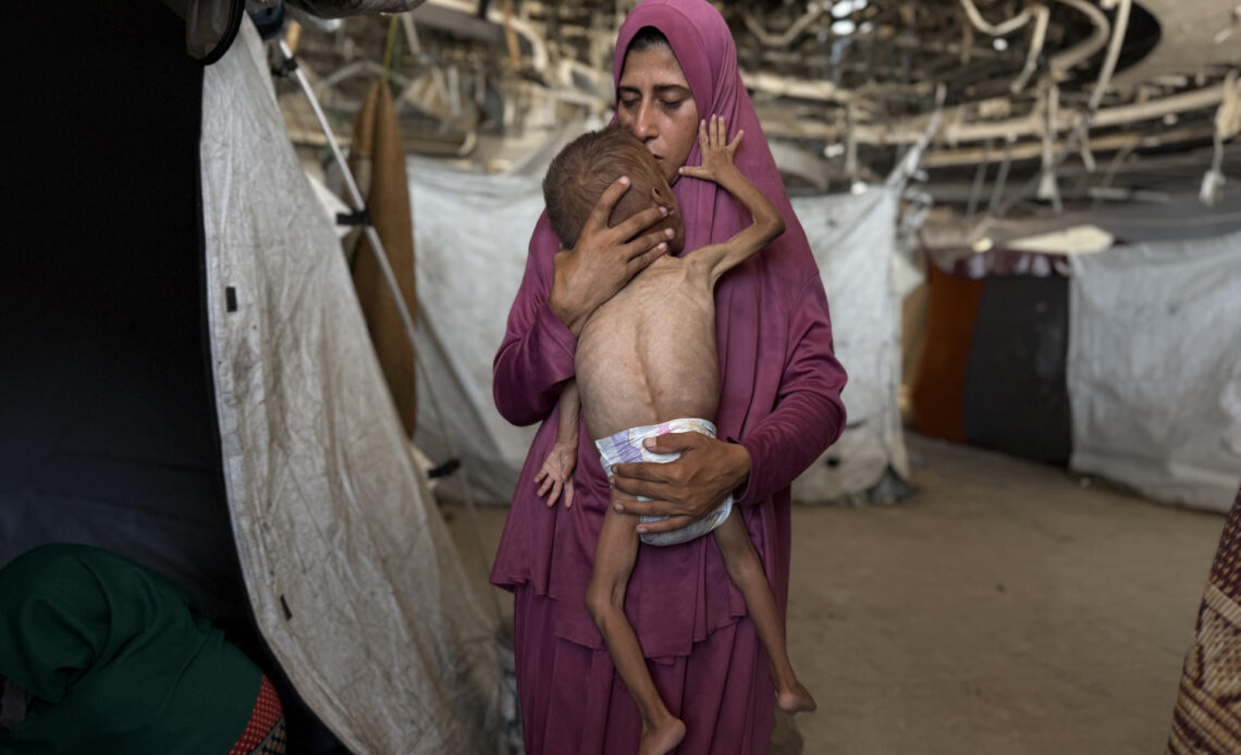 Un niño gazatí de 18 meses, de cuerpo esquelético, en brazos de su madre en una imagen del 26 de julio de 2025. Efe/ahmad awad