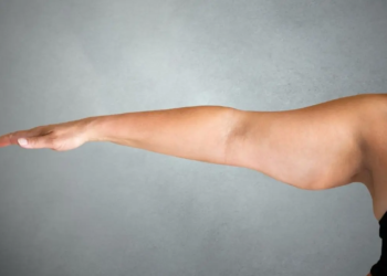 Estrategias para eliminar la grasa y flacidez en los brazos